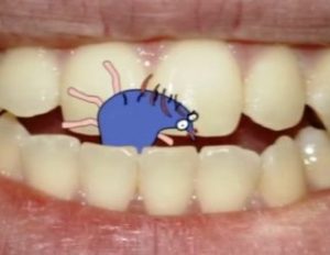 Как бороться с главным врагом зубов – кариесом