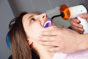 Зубная пломба – основной враг кариеса